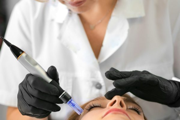 Facial mesotherapy with microneedles