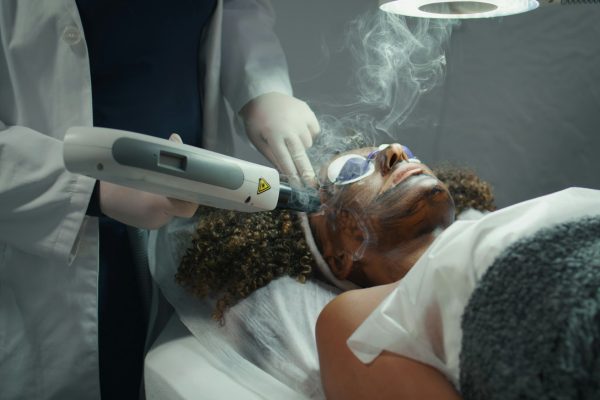 Laser pulsing patient face closeup. Cosmetician hands peeling exfoliating skin.